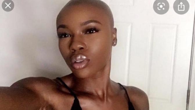 Do guys find bald girls attractive?
