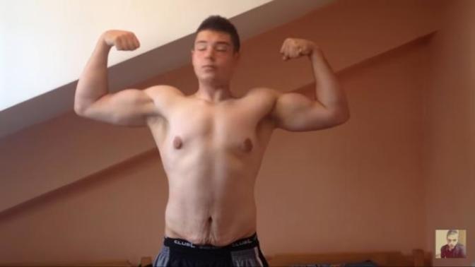 Loose skin and weight loss?