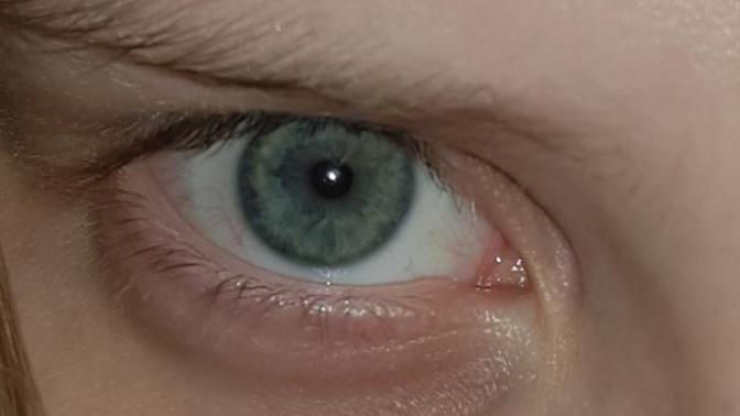 What eye color is this?