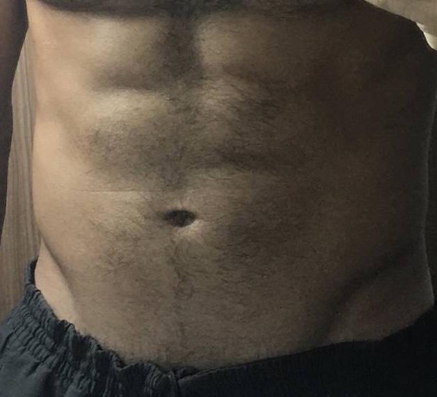 Girls, Hairy tummy vs no hair? Which one is mor attractive? What do you think about the tummy trail to the belly button?