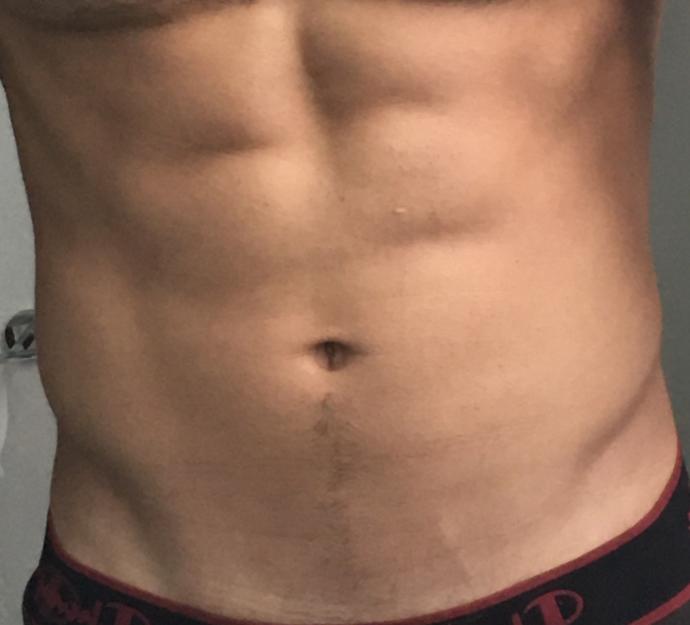Girls, Hairy tummy vs no hair? Which one is mor attractive? What do you think about the tummy trail to the belly button?