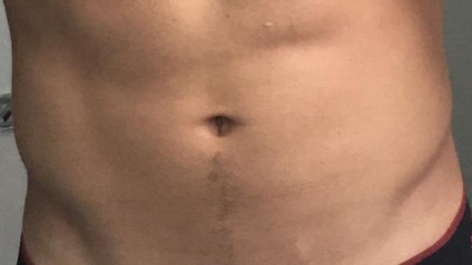 Girls, Hairy tummy vs no hair? Which one is mor attractive? What do you think about the tummy trail to the belly button?