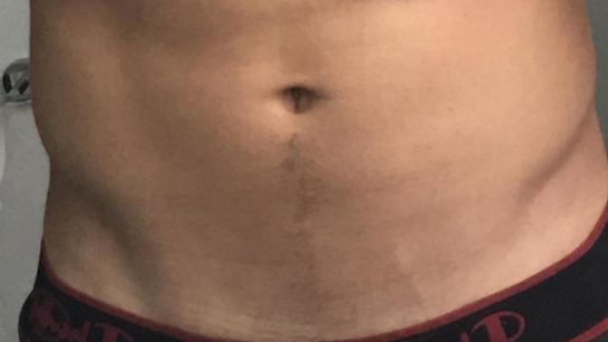 Girls, Do girls prefer a hair trail from navel to the secret spot? Is it attractive? Do you prefer it to be trimmed or thick (See pick below)?