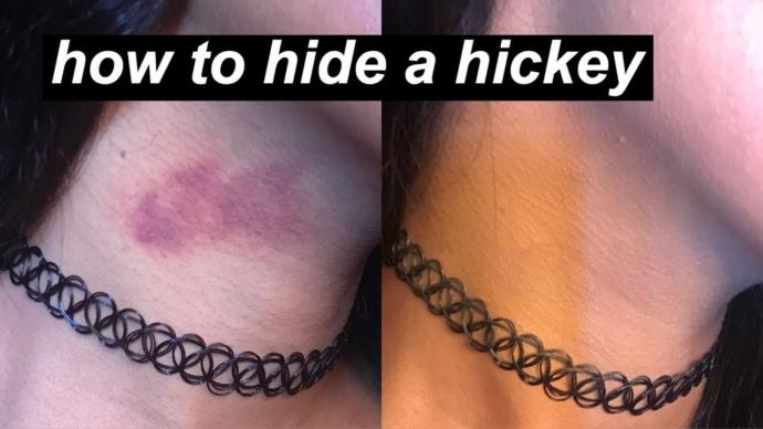 Are hickeys trashy to you?
