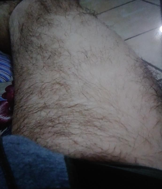 Patchy hair growth, is it better to shave it off?