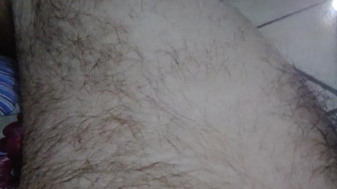 Patchy hair growth, is it better to shave it off?