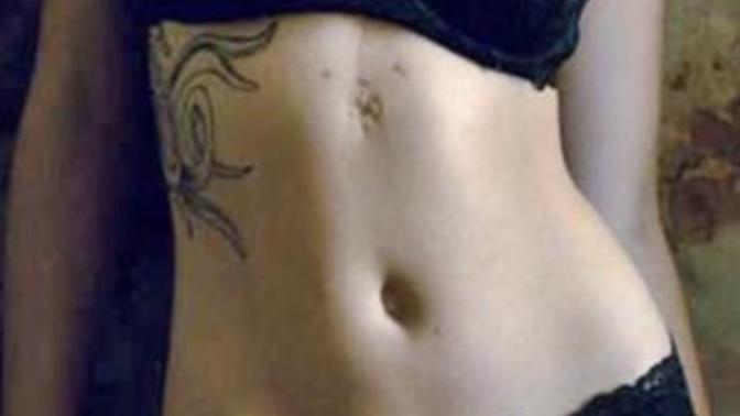 Open Heart Surgery Scar. Put Off or Not?