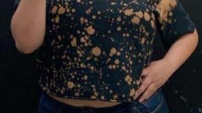 How would you react if your SO gained 100 lbs of fat? What do you say about where their fat was put on?