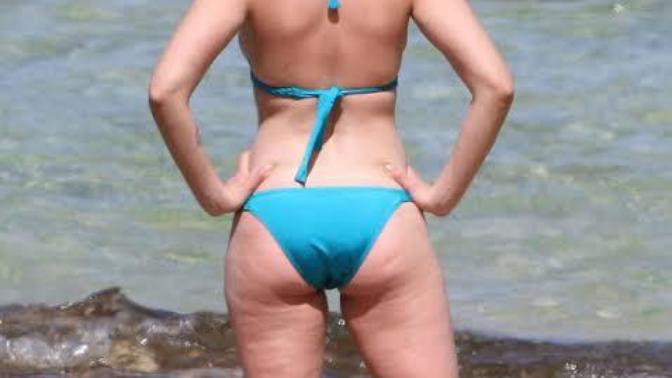 Do you find cellulite unattractive?