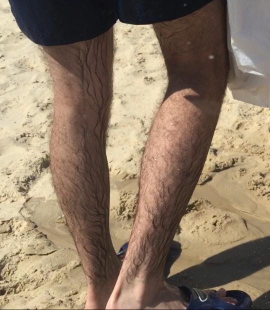 Should he remove his leg and arm hair?