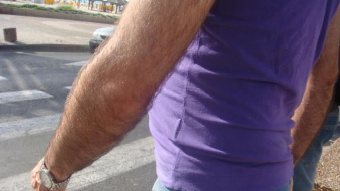 Should he remove his leg and arm hair?