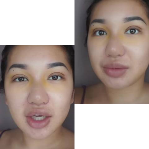 Do you think having a big nose is unattractive?