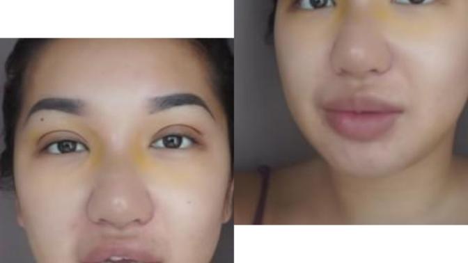 Do you think having a big nose is unattractive?