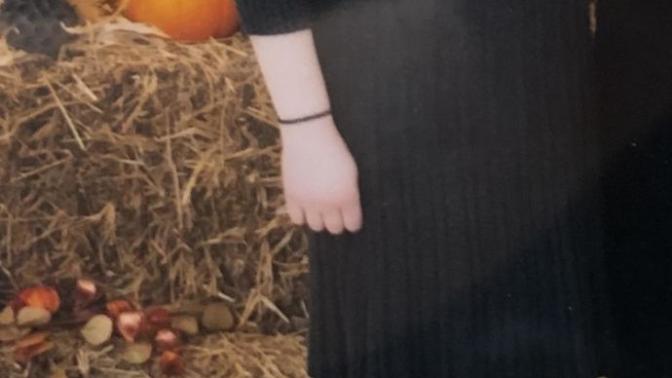 Here’s a picture of my body. should I lose like 20 lbs?