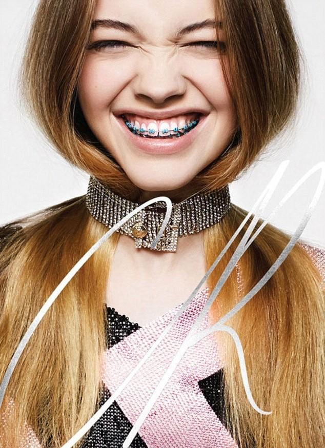 Do you consider orthodontic braces attractive on those 18+?