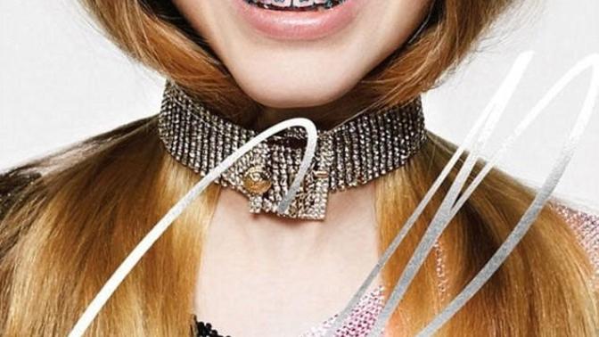 Do you consider orthodontic braces attractive on those 18+?
