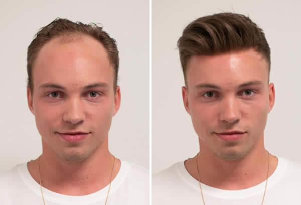 Women, would you be turned off if a mans hair wasnt real?