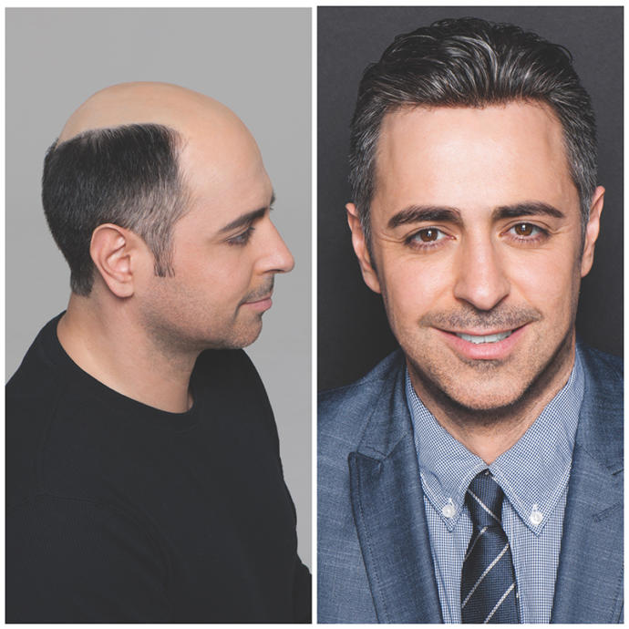 Women, would you be turned off if a mans hair wasnt real?