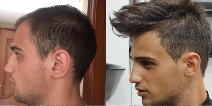Women, would you be turned off if a mans hair wasnt real?