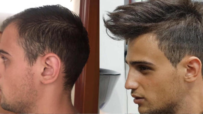 Women, would you be turned off if a man's hair wasn't real?