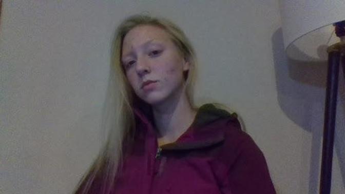 Guys, do I look bad? with my acne I mean?