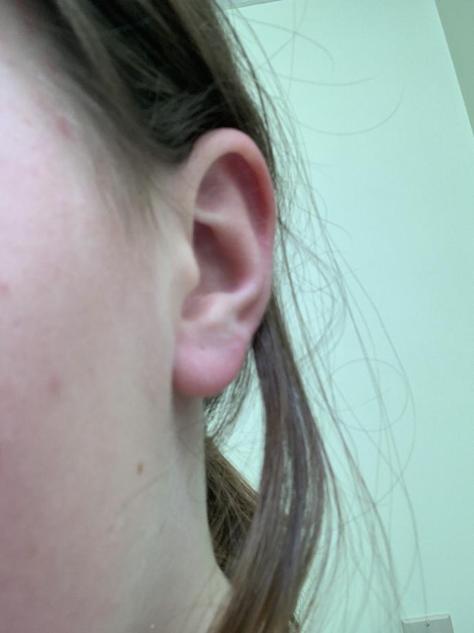 Insanely uneven ear piercings?
