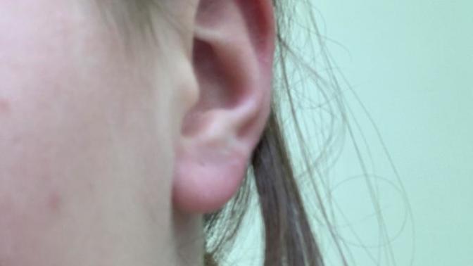 Insanely uneven ear piercings?
