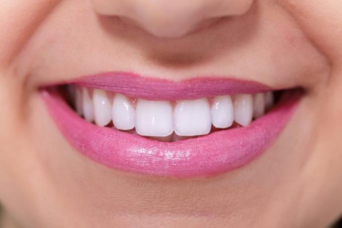 How important are white teeth?