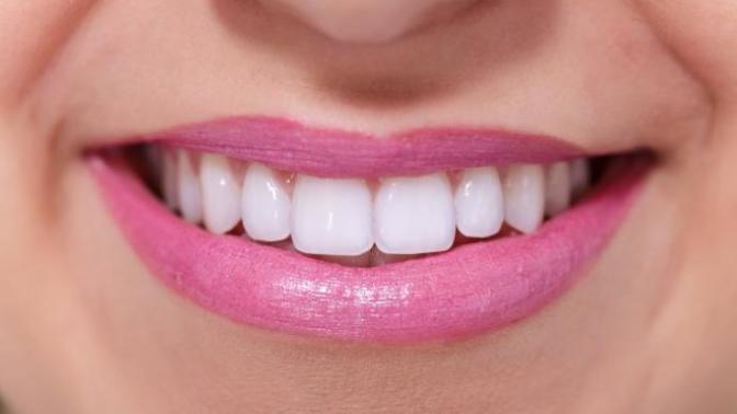 How important are white teeth?