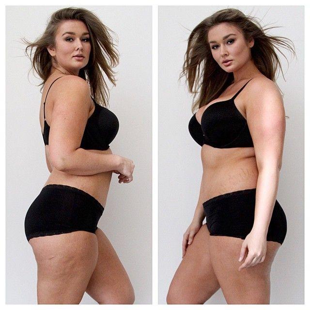 Are stretch marks a turn off for guys?