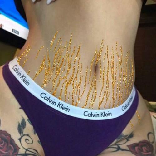 Are stretch marks a turn off for guys?