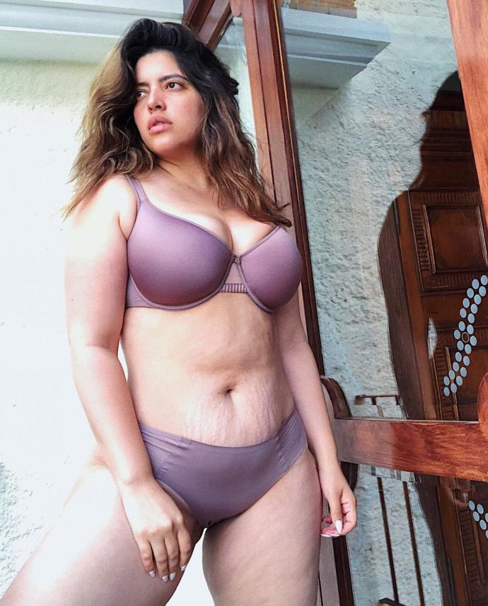 Are stretch marks a turn off for guys?