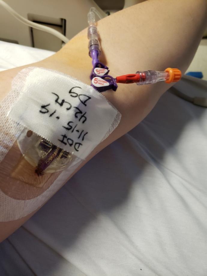 Have you been hospitalized before?