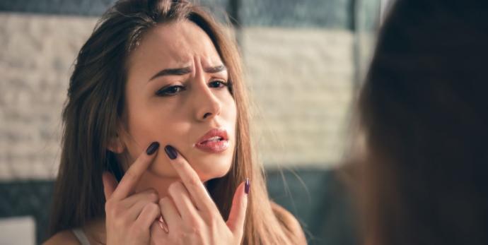 Why do I always get pimples when Im about to have my period?