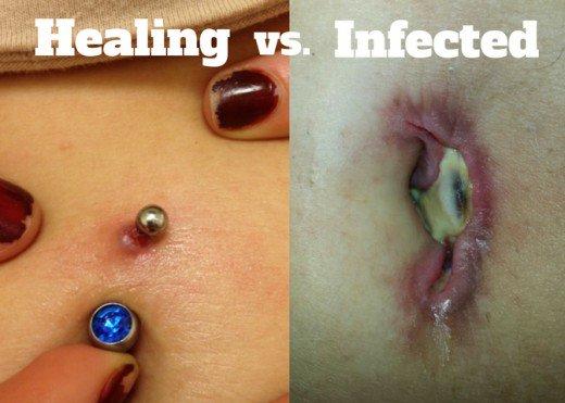 What is your opinion on belly piercing?