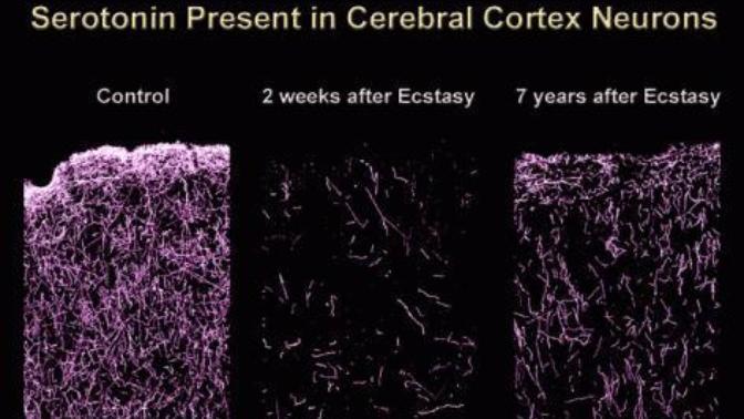 Have you ever taken Ecstasy?