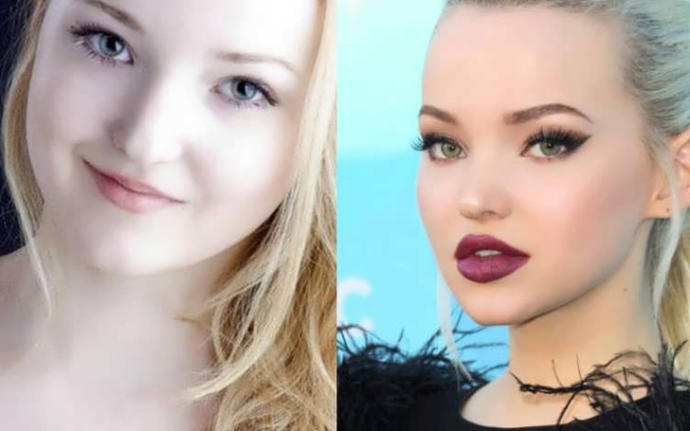 Lip fillers, guys, what do you guys really think about them? Like them? Or not? Don’t care?