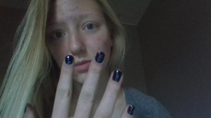 Girls, How to get nail polish off your skin around your nails without nail polish remover?