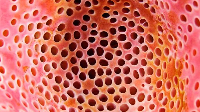 Do you have Trypophobia?