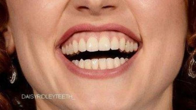 How do you feel about Daisy Ridley's teeth?