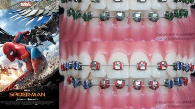 Have You Ever Had Braces?