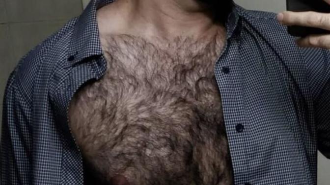 Would you break up with someone just because the person is so hairy?