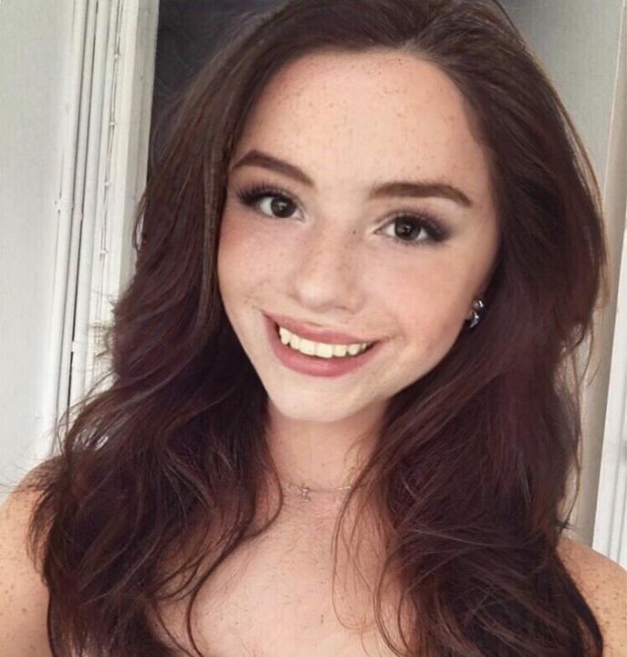 Are bad teeth a deal breaker?