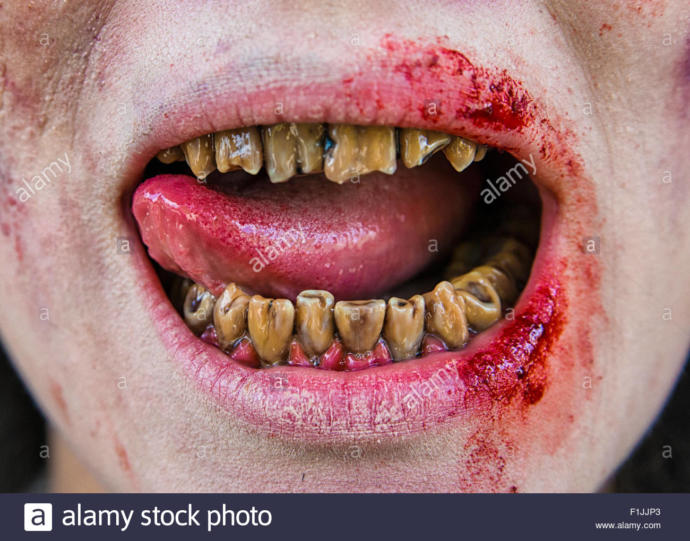 Are bad teeth a deal breaker?