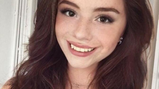 Are bad teeth a deal breaker?