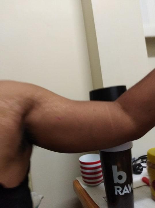 Are stretch marks like this unattractive?
