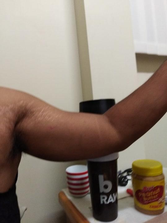 Are stretch marks like this unattractive?