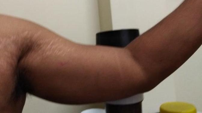 Are stretch marks like this unattractive?