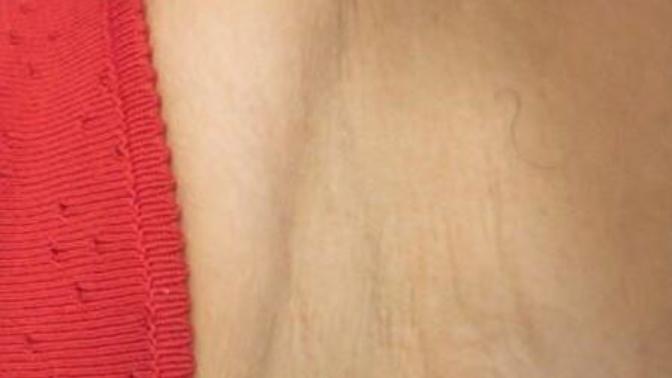 Girls, how could she have left a hair shaft on her armpit😂?