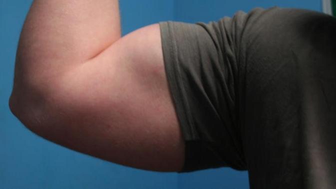 Judging from my arm, should I focus on building muscle, or burning off fat?